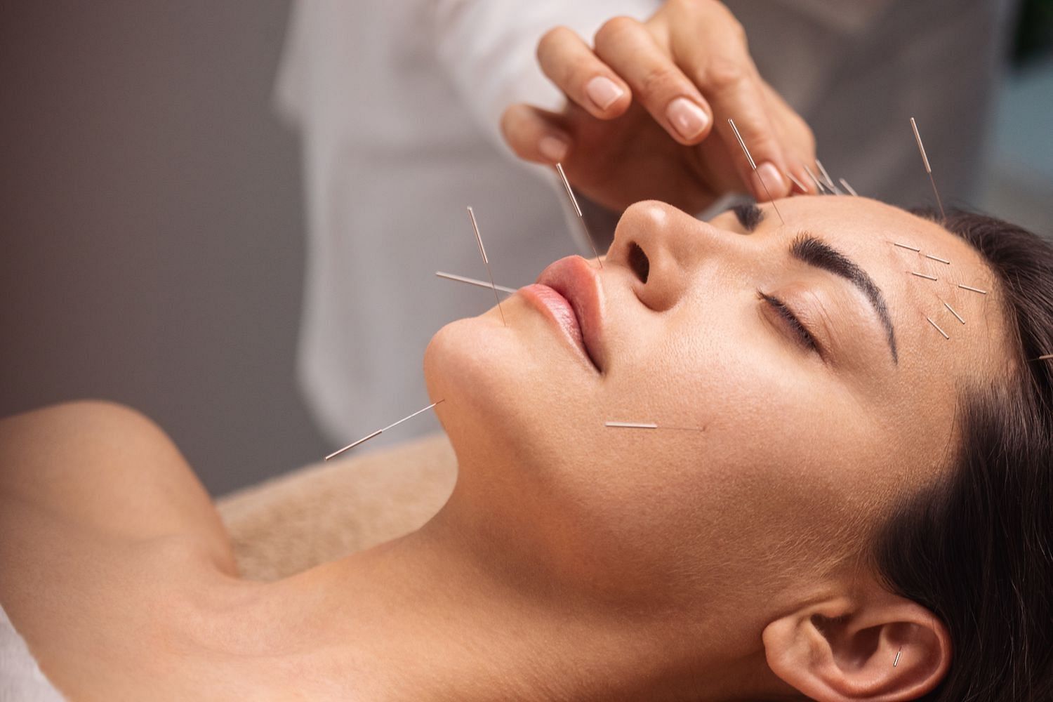 Acupuncturist performing the method on a patient (Image via Getty Images)