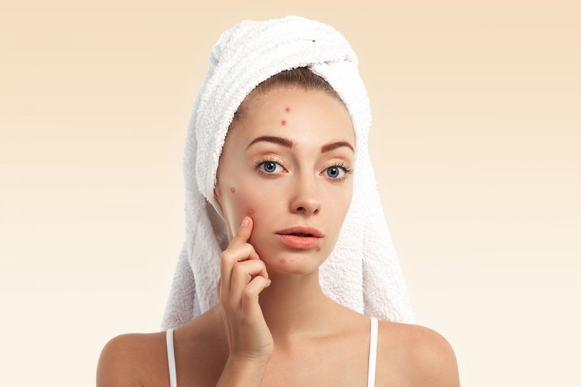 Oregano essential oil may reduce acne. (Photo via Freepik)