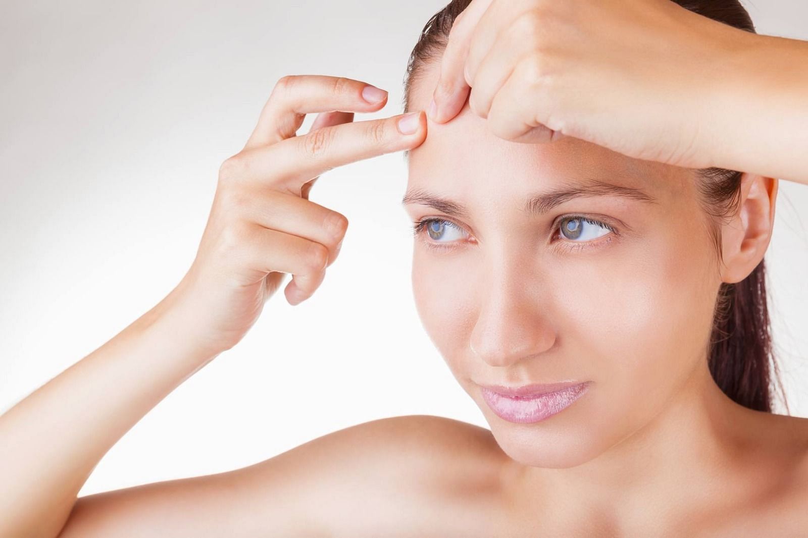 Acne on the forehead (Image via Getty Images)