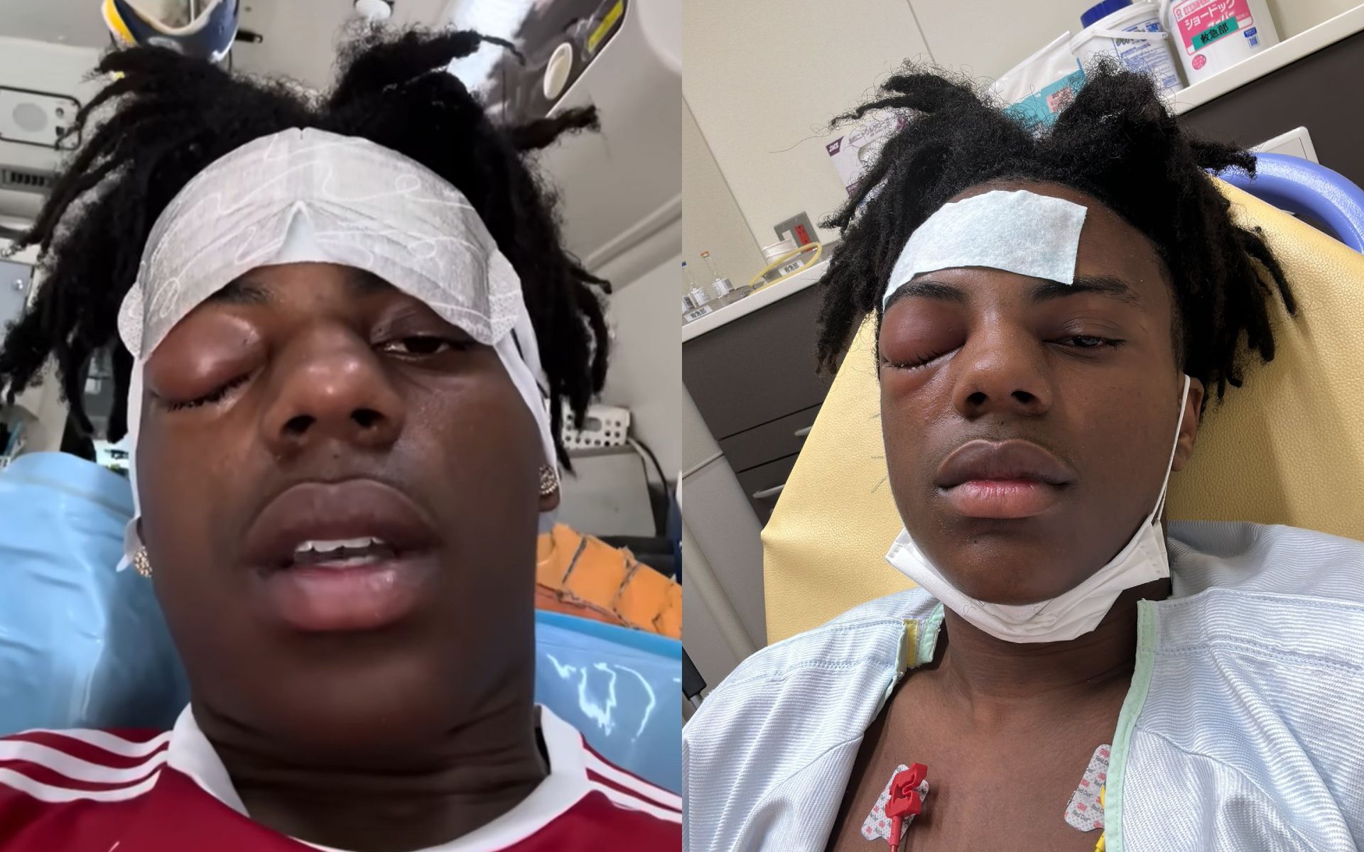 what happened to speed in the hospital｜TikTok Search