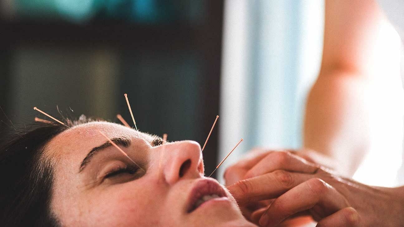 Acupuncturist performing the method on a patient (Image via Getty Images)