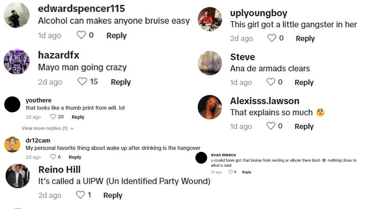 The comments on Gia Duddy&#039;s TikTok page seemingly tried to convince her of other reasons why she has bruises.