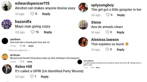 The comments on Gia Duddy's TikTok page seemingly tried to convince her of other reasons why she has bruises.