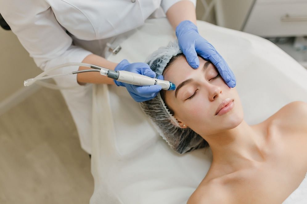 Is laser skin resurfacing worth the hype (image via freepik/lookstudio)