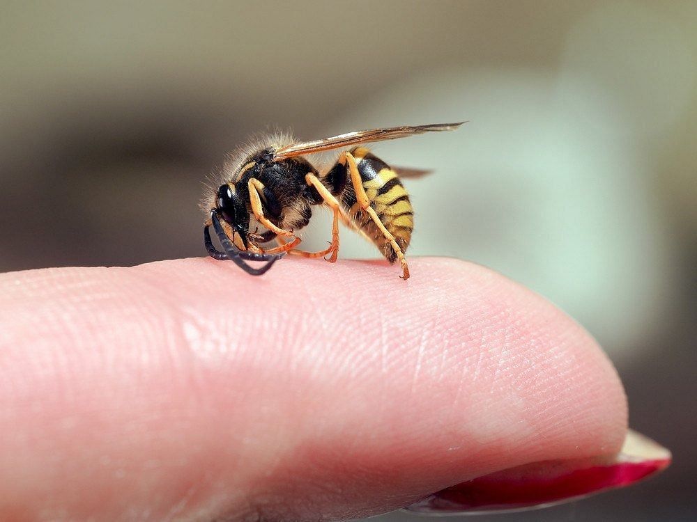 Wasp sting (Image via Getty Images)
