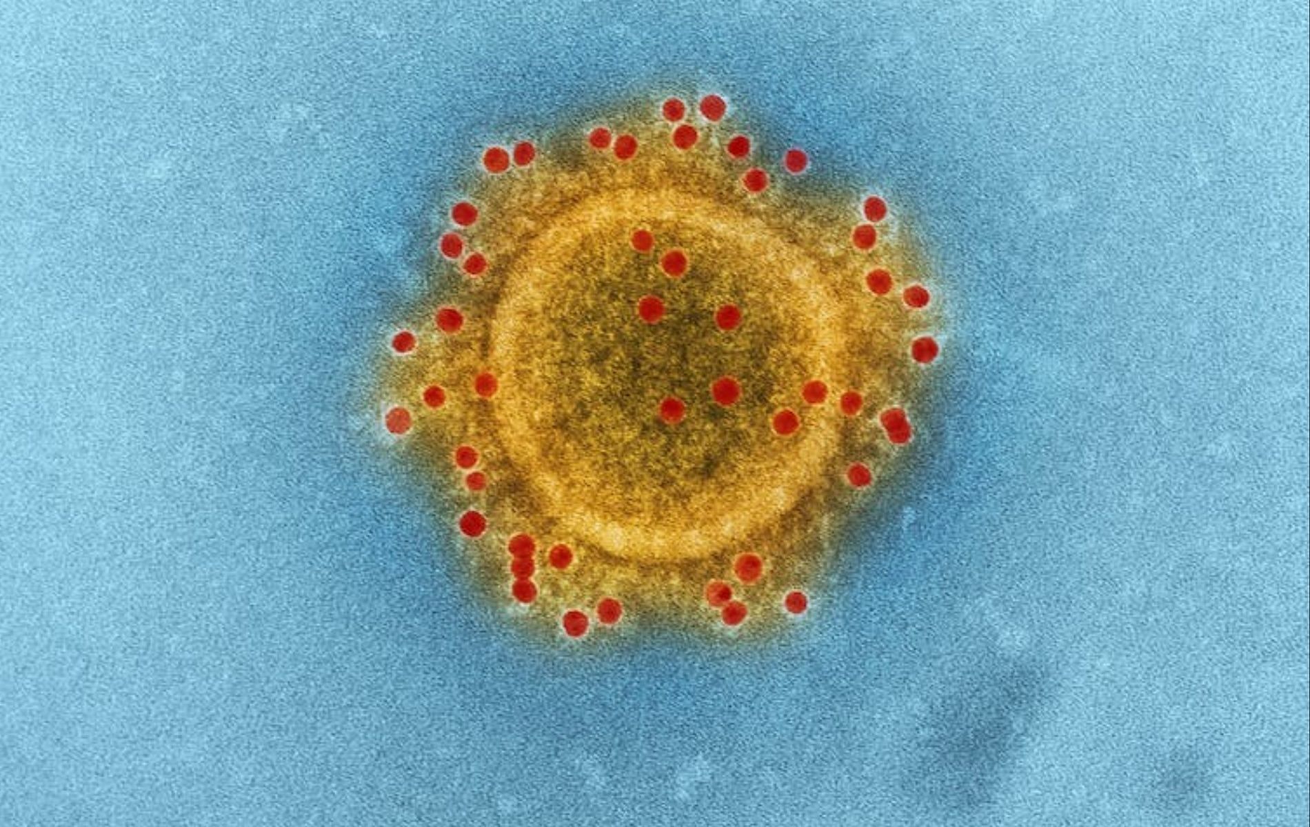 microscopic shot of a virus (Image via CDC)