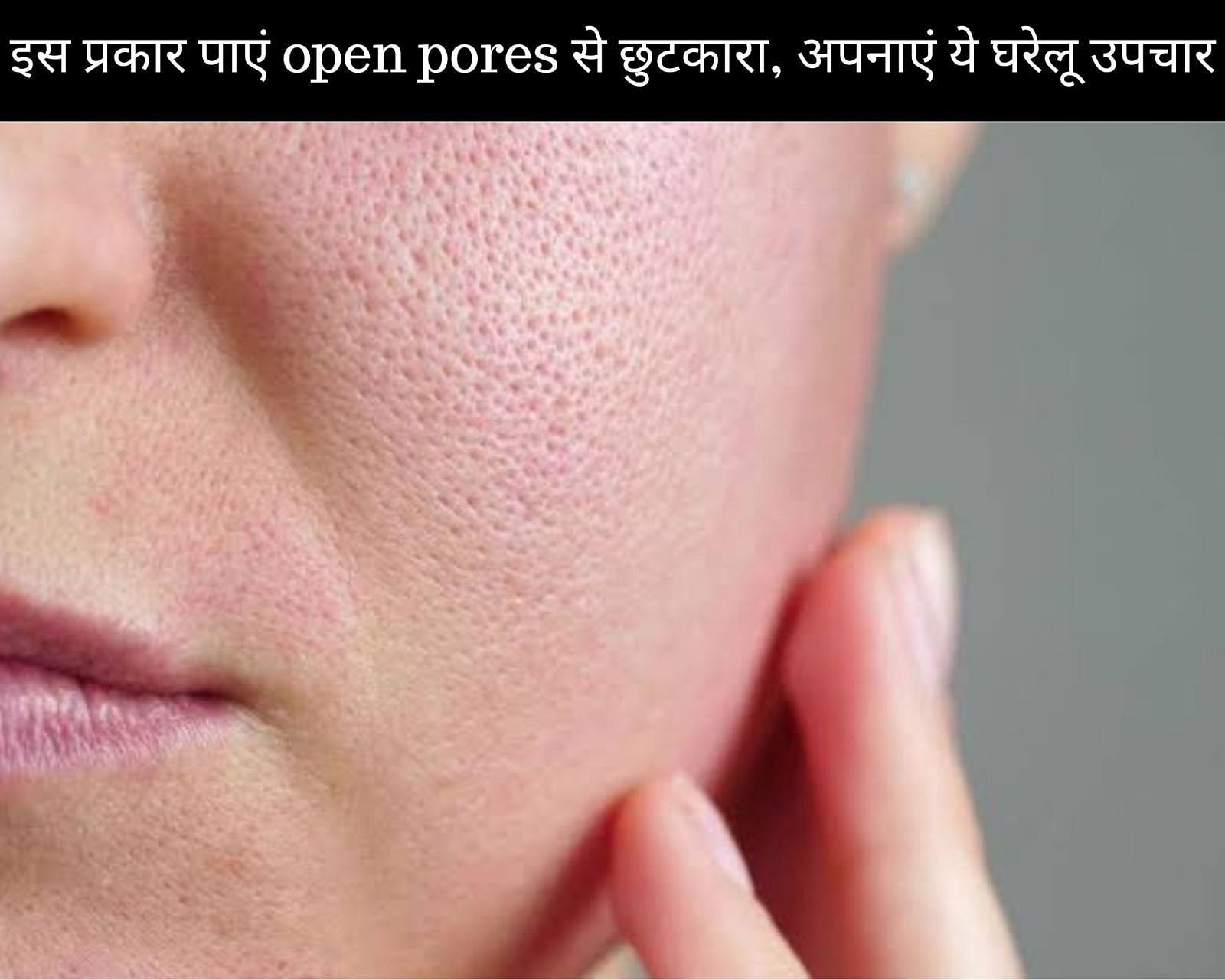 इस प्रकार पाएं open pores से छुटकारा, अपनाएं ये 12 घरेलू उपचार (फोटो - sportskeedaहिन्दी)