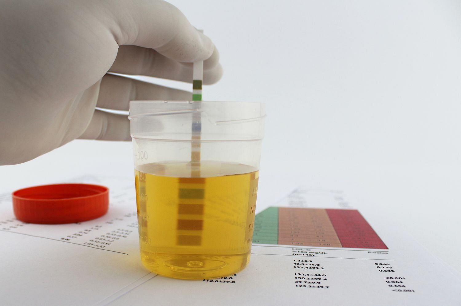 Protein in urine sample (Image via Getty)
