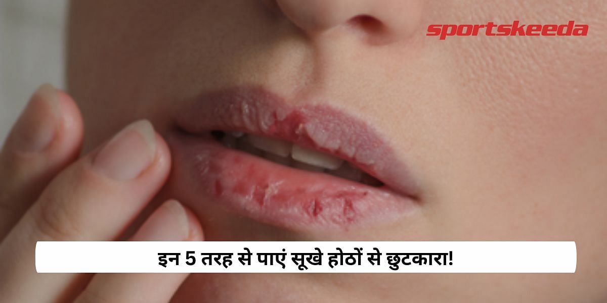 Get rid of dry lips in these 5 ways!