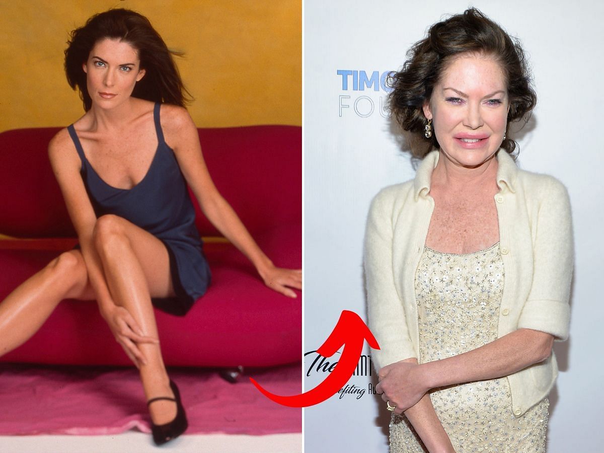 Lara Flynn Boyle before (left) and after (right) surgery (Images via Getty)