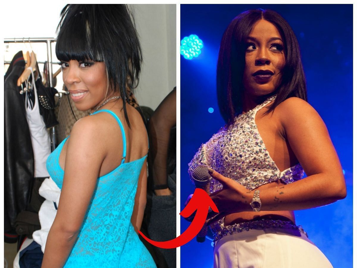 K Michelle before (left) and after (right) surgery (Images via Getty)