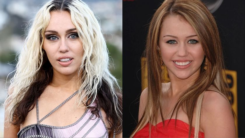miley cyrus teeth before and after