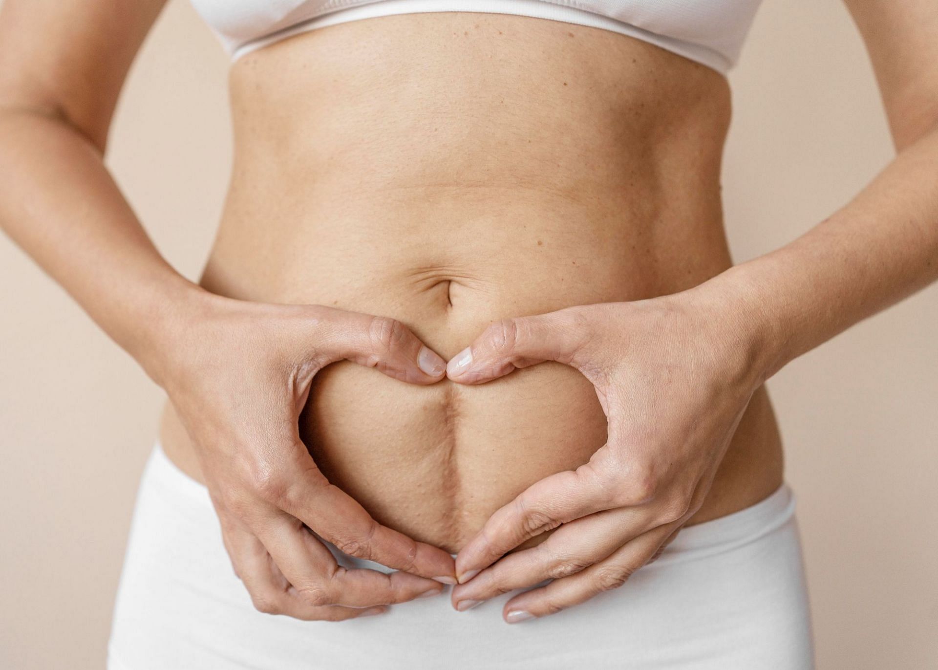 Tips for weight loss after a C-section. (Photo via Freepik)