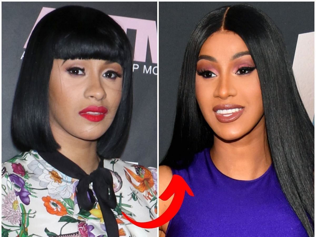 Cardi B before (left) and after (right) surgery (Images via Getty)