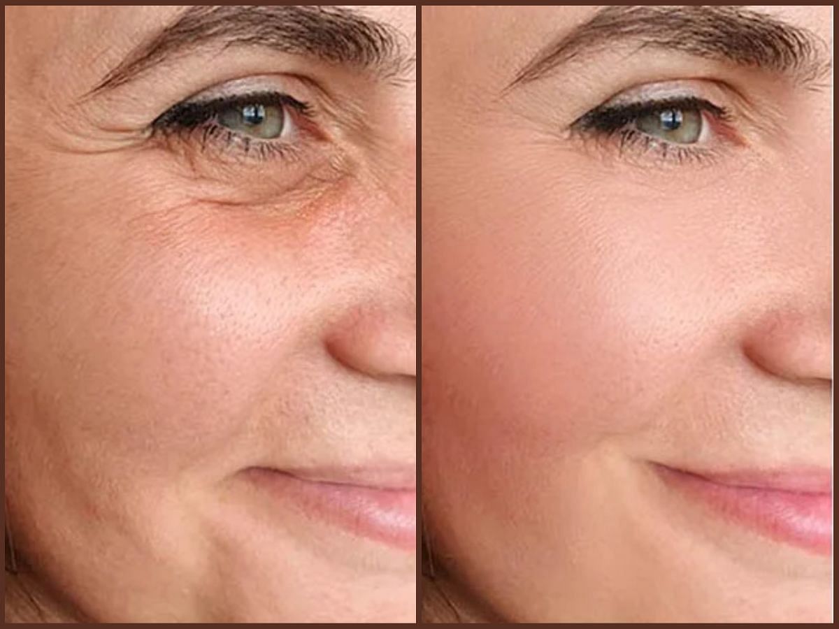 how-to-get-an-instant-face-lift-5-best-non-surgical-methods-explained