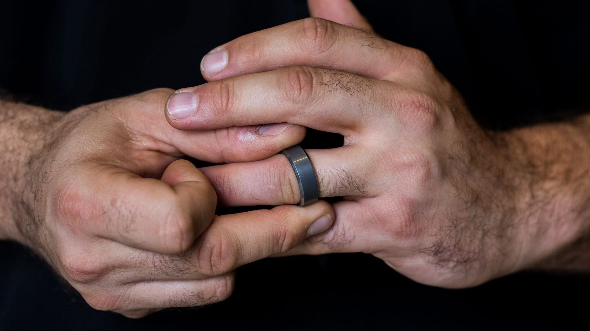 Fidgeting with fingers is a common symptom of anxiety. (Image via Gettyimages/ Getty)