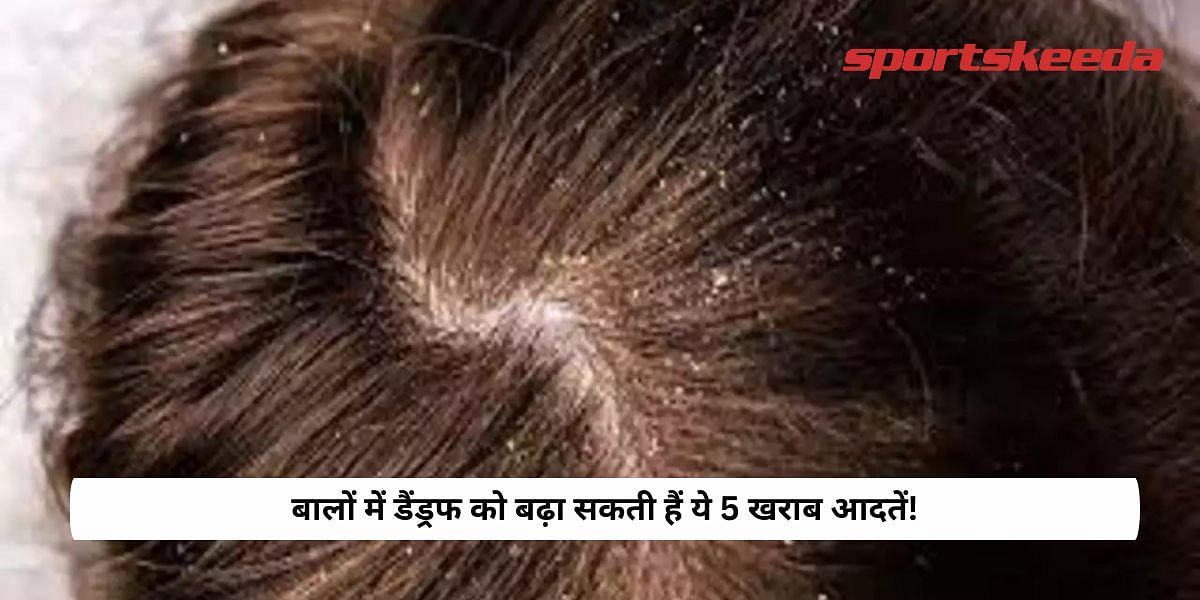 These 5 bad habits can increase dandruff in hair!