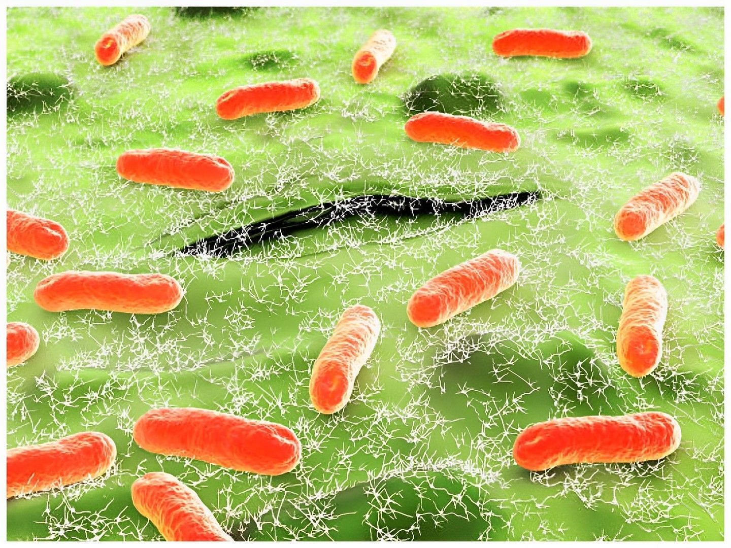 CDC Has Identified a New Strain of E. coli That May Be Causing Recent