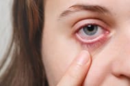 TED is an eye disorder. (Photo via Freepik/user18526052)