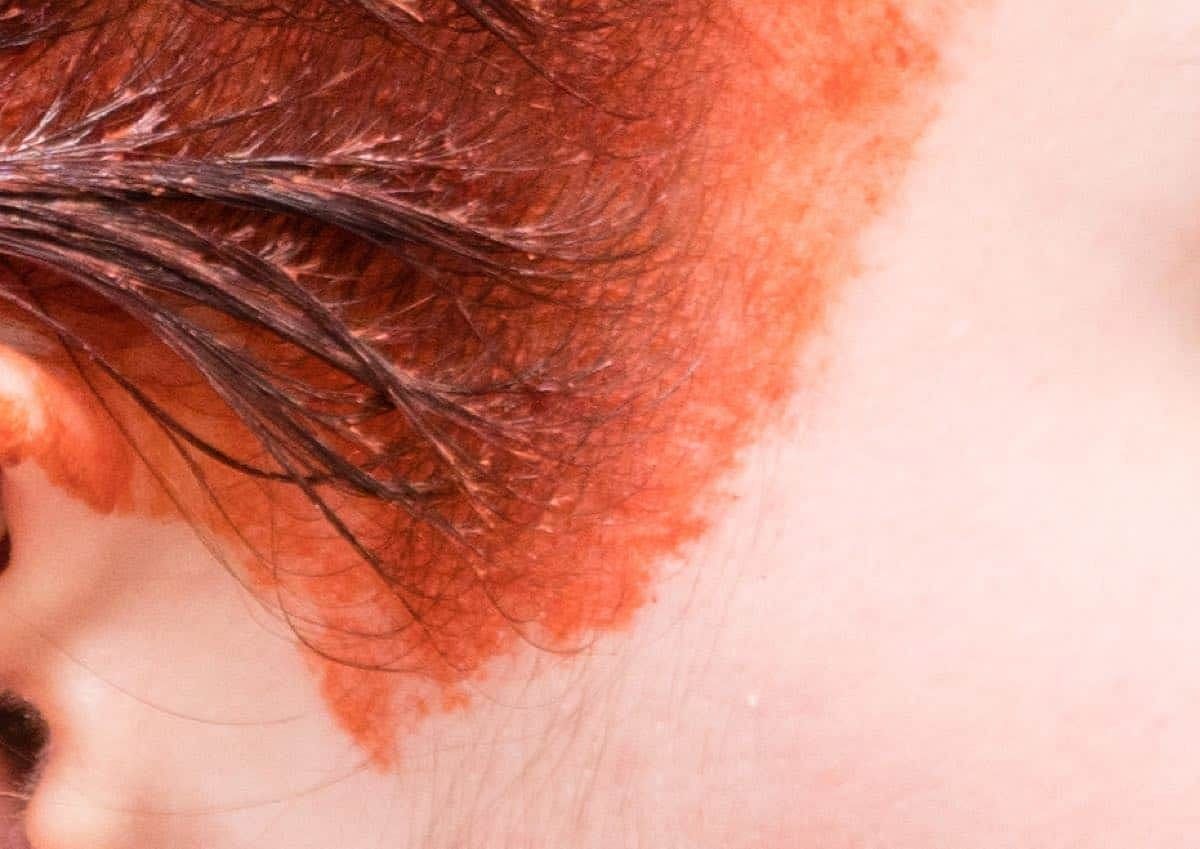 Remove hair dye from skin (Image via Getty Images)