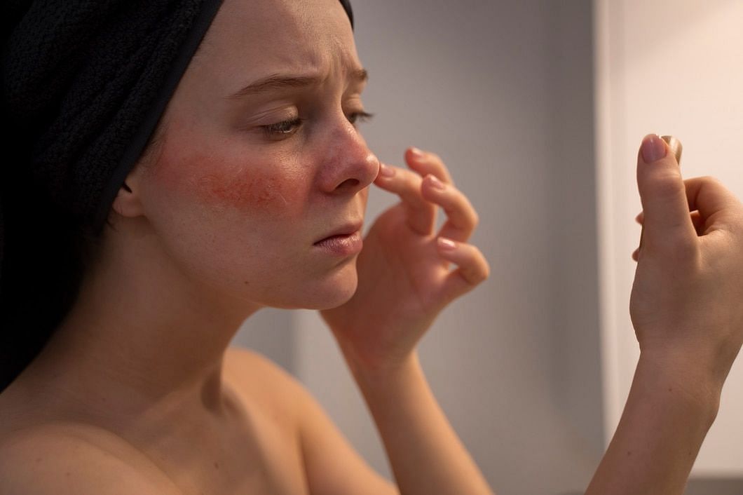 Dryness is a common worry for sensitive skin (Image via freepik)