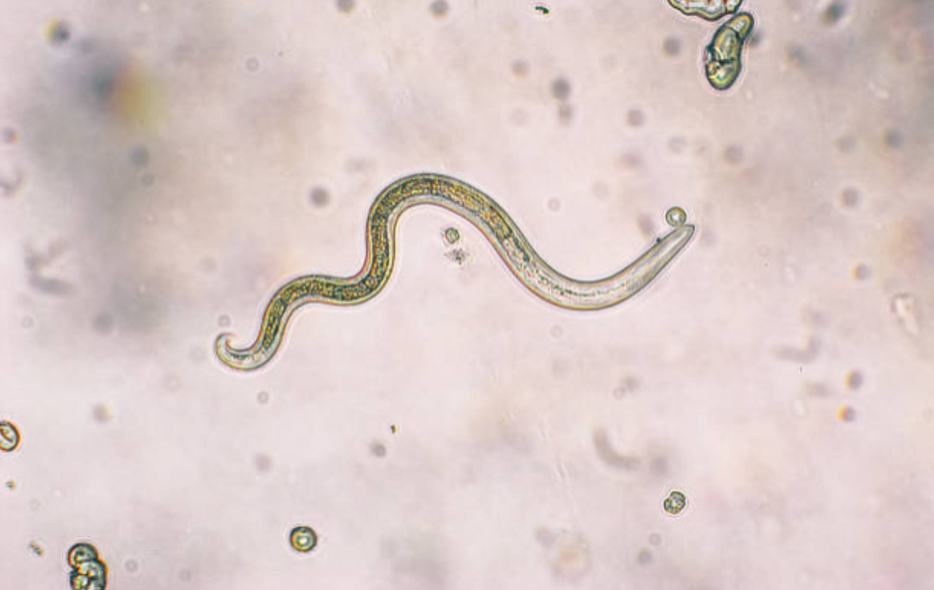 Parasitic species of roundworm found living inside human being for the first time. (Image by iStockphoto via Pexels)