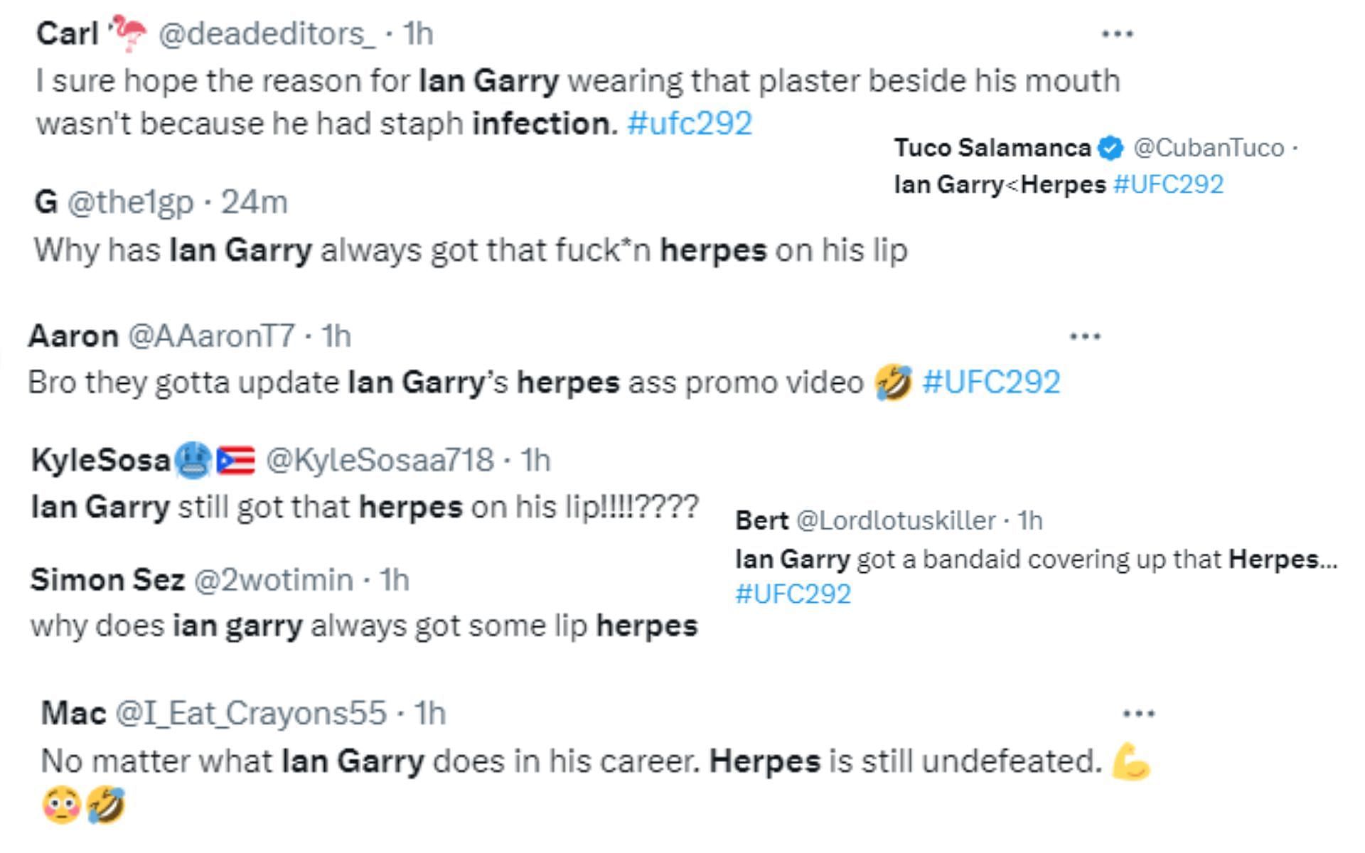 Does Ian Garry Have Herpes? Mouth Scar Triggers Fan Speculations During ...