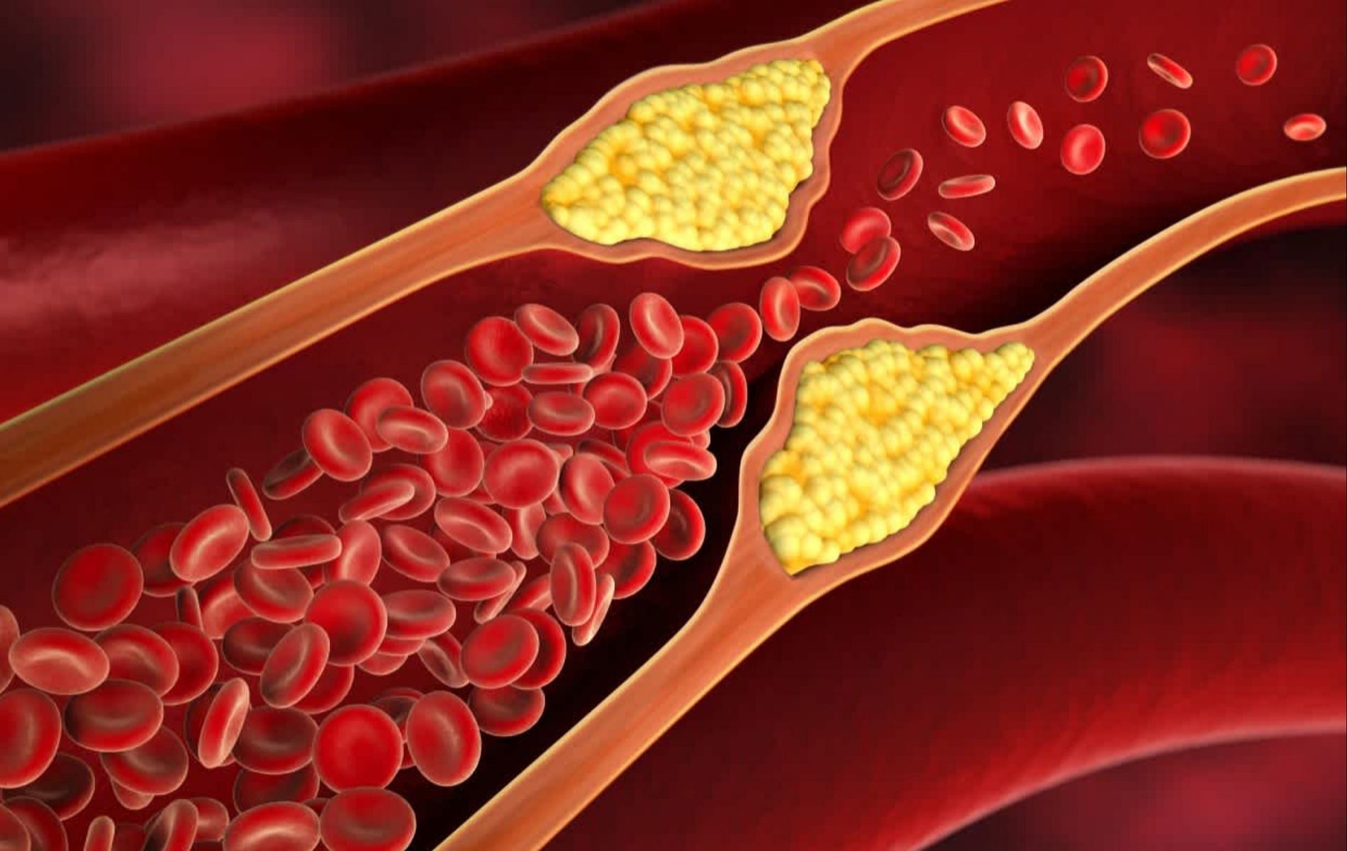 As per certain research, EPO might have some beneficial effects on cholesterol levels (Image via Everlywell)