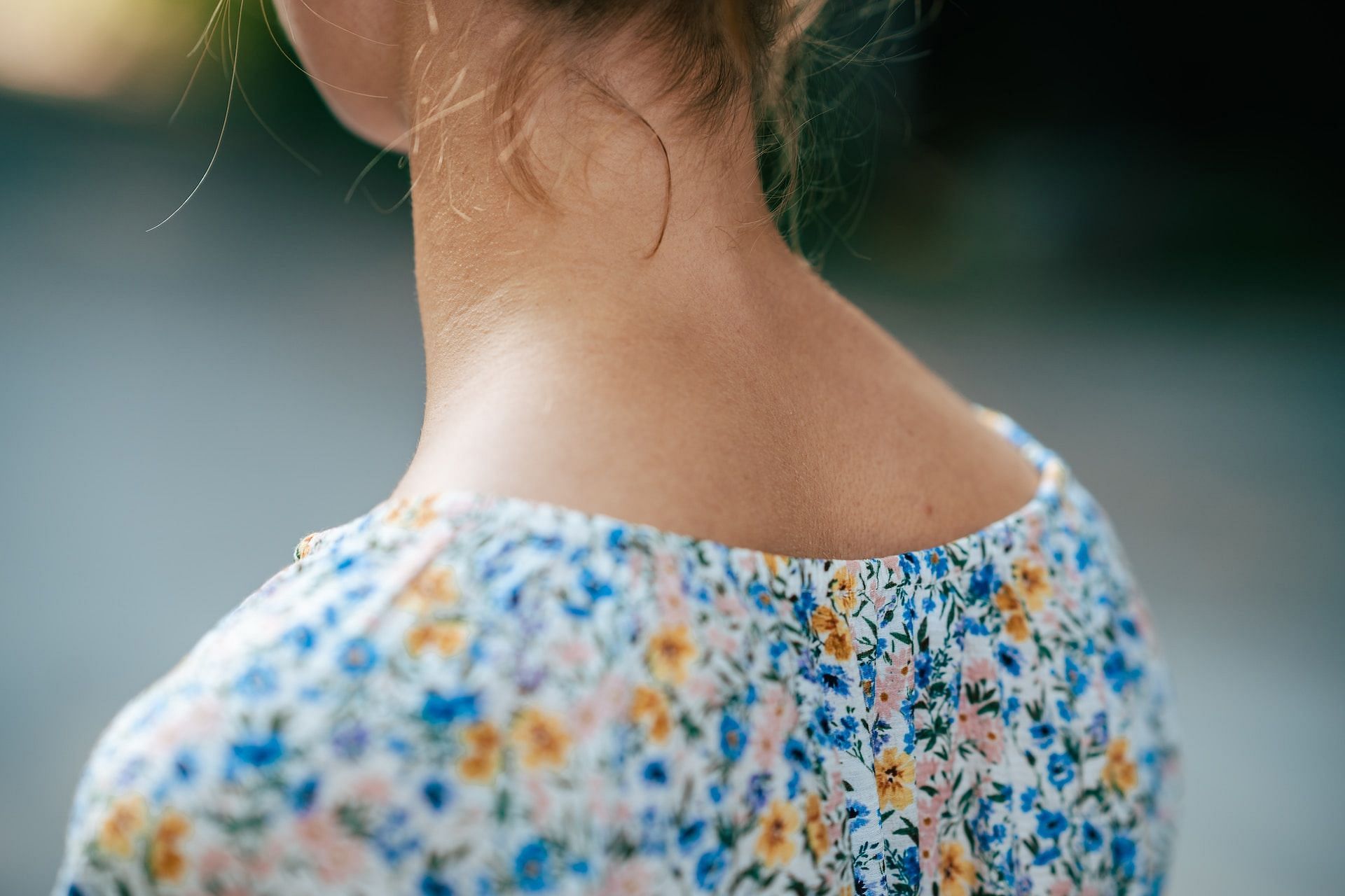 Dark neck can occur due to exposure to sun. (Photo via Unsplash/Andrey K)