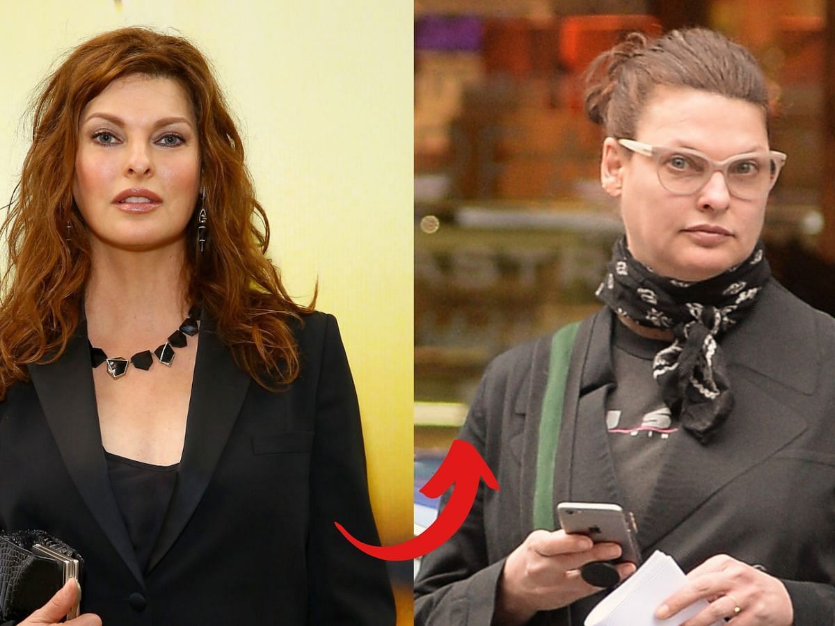 Linda Evangelista before (left) and after (right) surgery (Images via Getty)