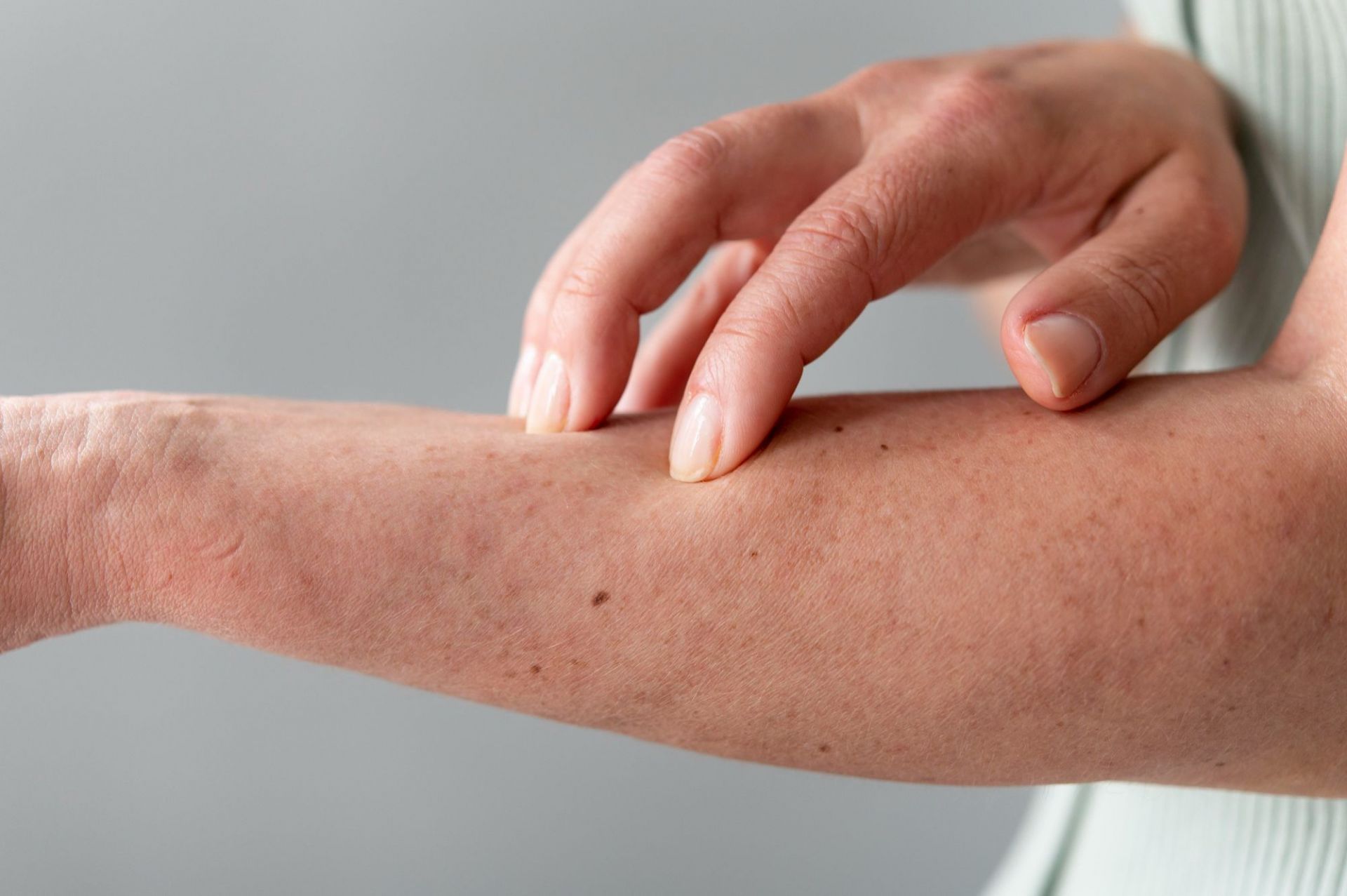 Laundry detergent allergy All about its symptoms and treatment