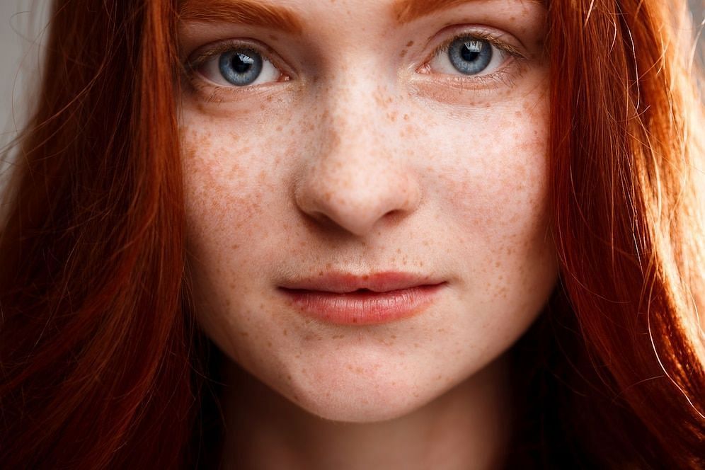 New freckles (Image via Freepik/Cookie_studio)