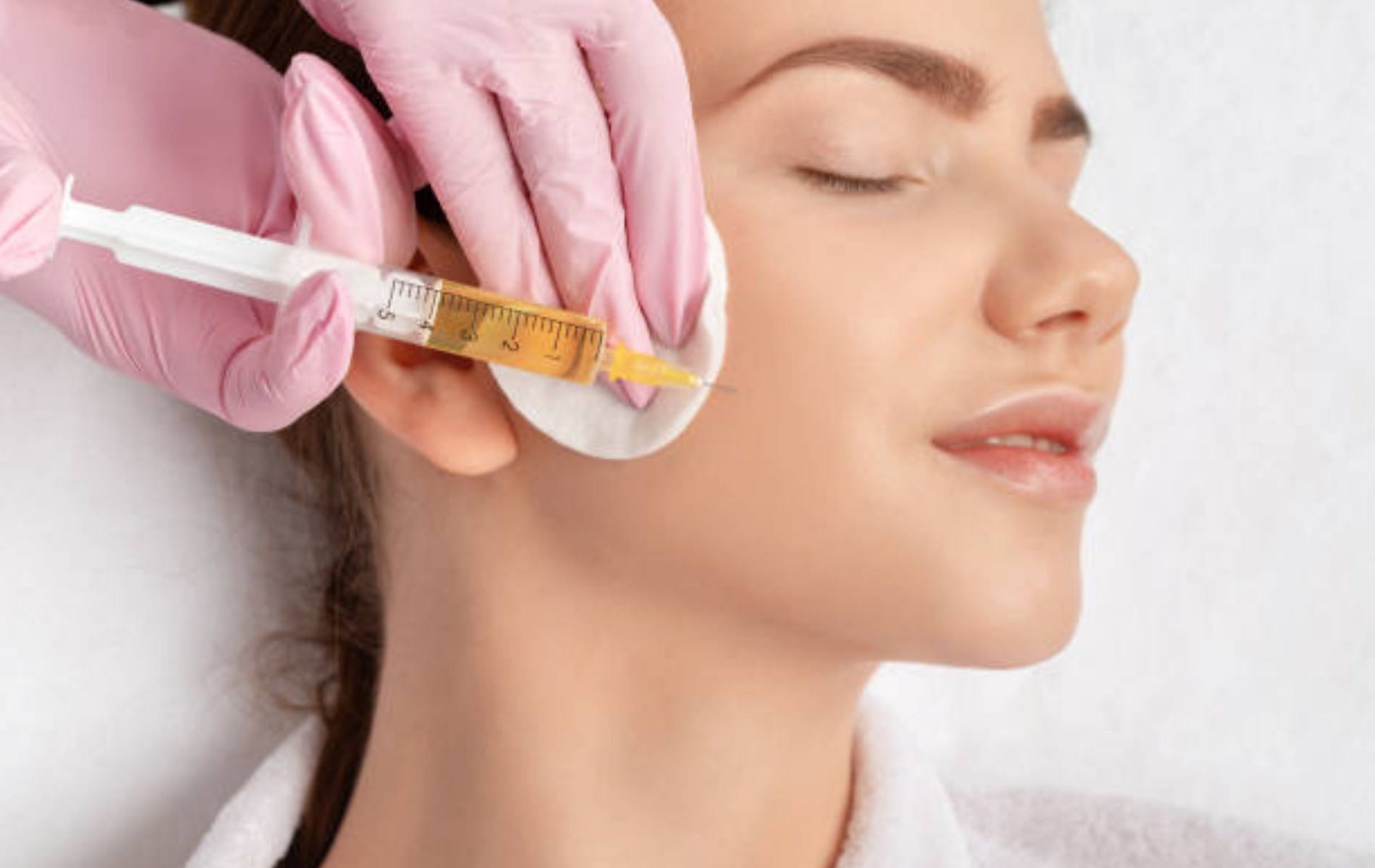 PRP Therapy or Platelet-Rich Plasma treatment for skin (Image by iStock photos via Pexels)