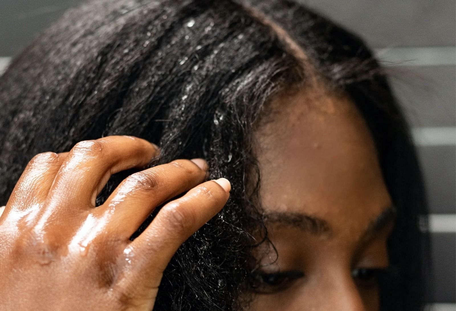 Coconut oil for dry scalp (Image via Getty Images)
