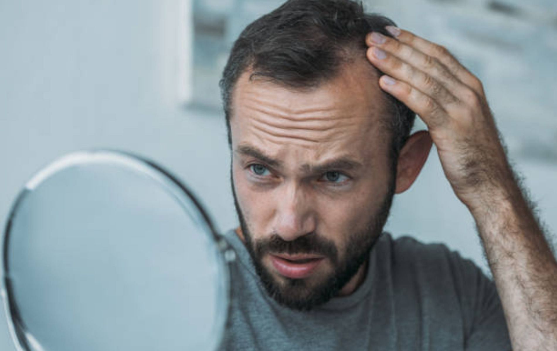 Vitamin D deficiency can cause severe hair loss (Image via iStockphotos via Pexels)