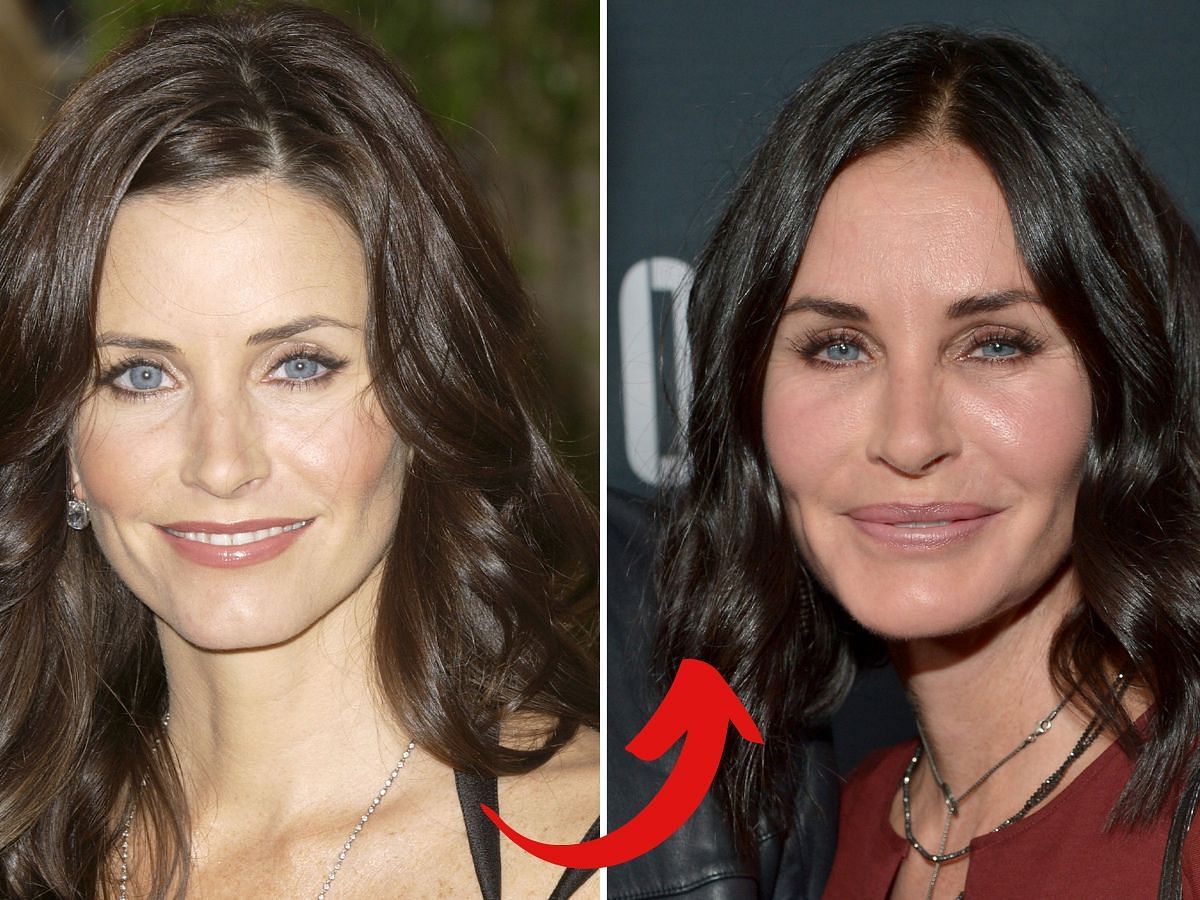 Courteney Cox before (left) and after (right) surgery (Images via Getty)