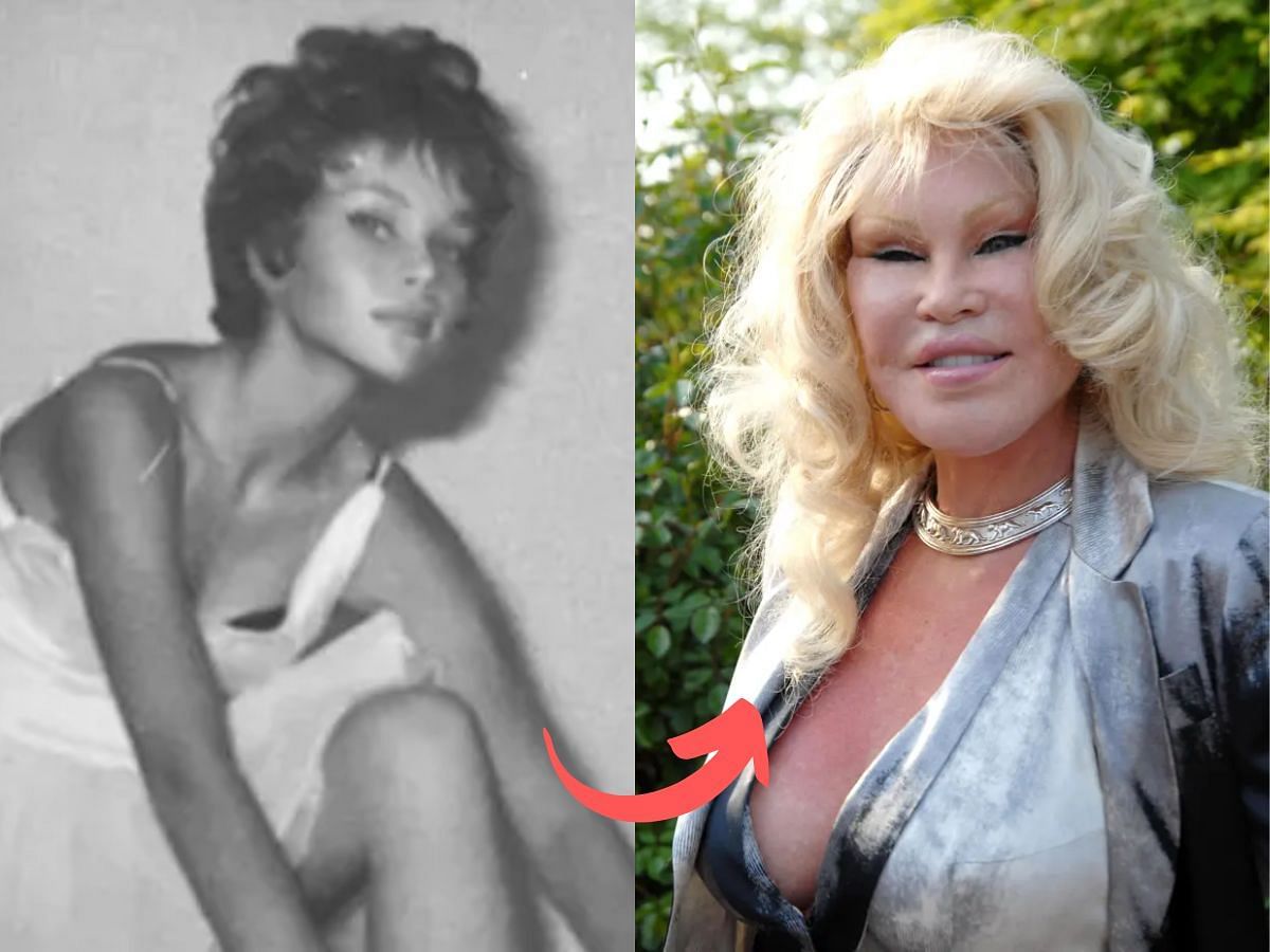 Jocelyn Wildenstein before (left) and after (right) surgery (Images via Getty)