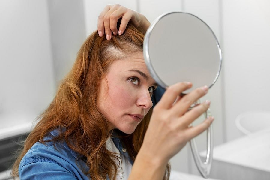 How to deal with scalp pimples (Image via freepik)