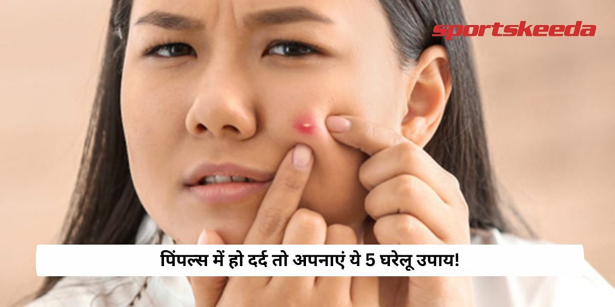 If there is pain in pimples then follow these 5 home remedies!