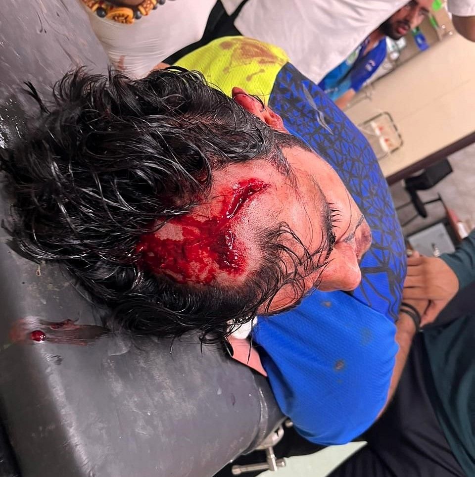 Delhi based kurash player Vishal Ruhil, who was selected in the 73kg, was injured in a brawl on Friday night in Delhi. Photo credit: Navneet Singh
