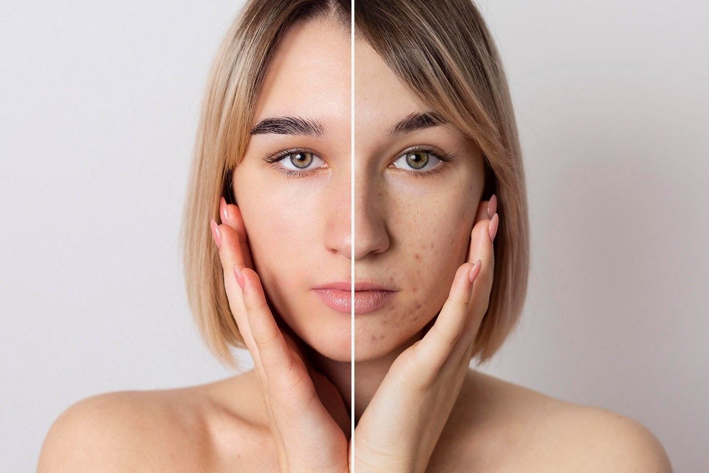 Hyperpigmentation is one of the most common skin issues prevailing in today&rsquo;s times (Image by Freepik on Freepik)