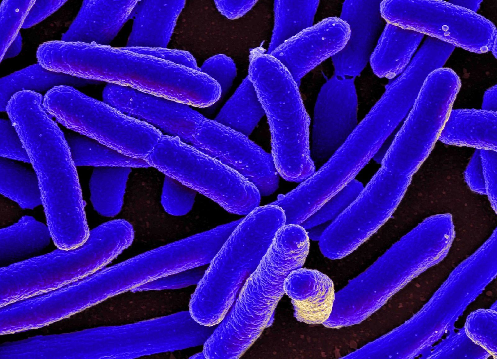 E.coli Outbreak (Image via Calgary Herald)