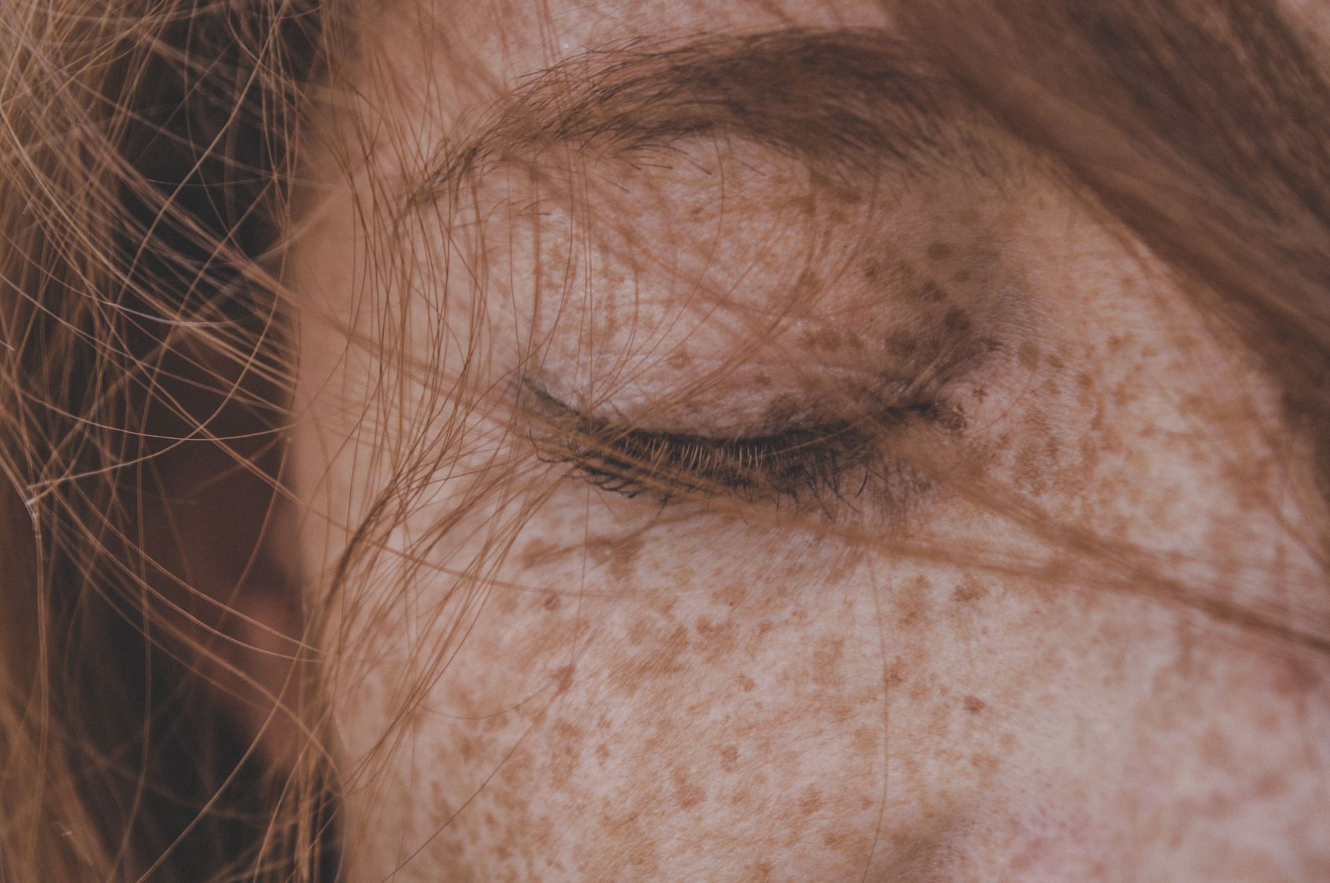 Pigmentation is one of the main side effects. (Image via Unsplash/Chermiti Mohamed)