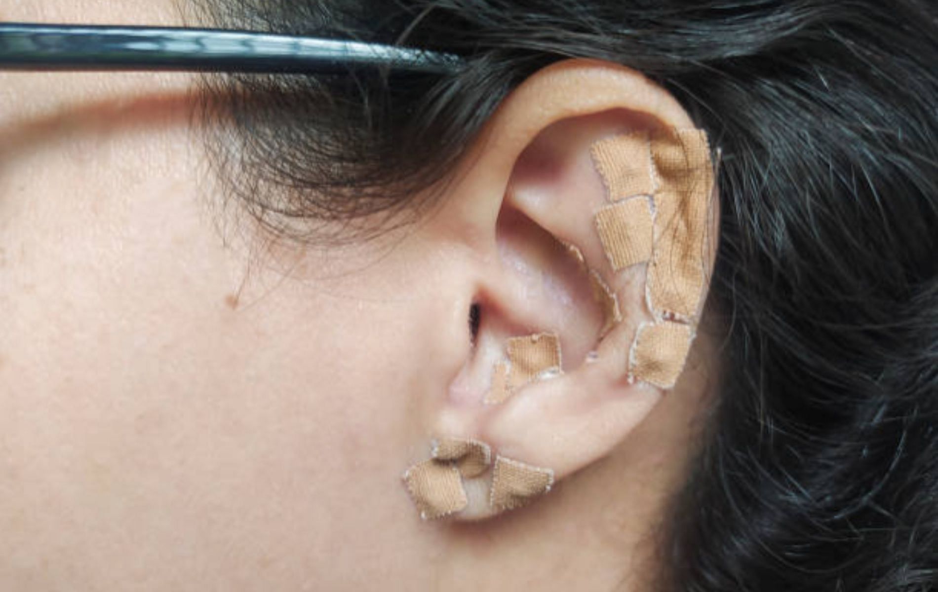Ear seeds are tiny seeds of the Vaccaria plant contained in latex stickers. (Image by iStockphoto)
