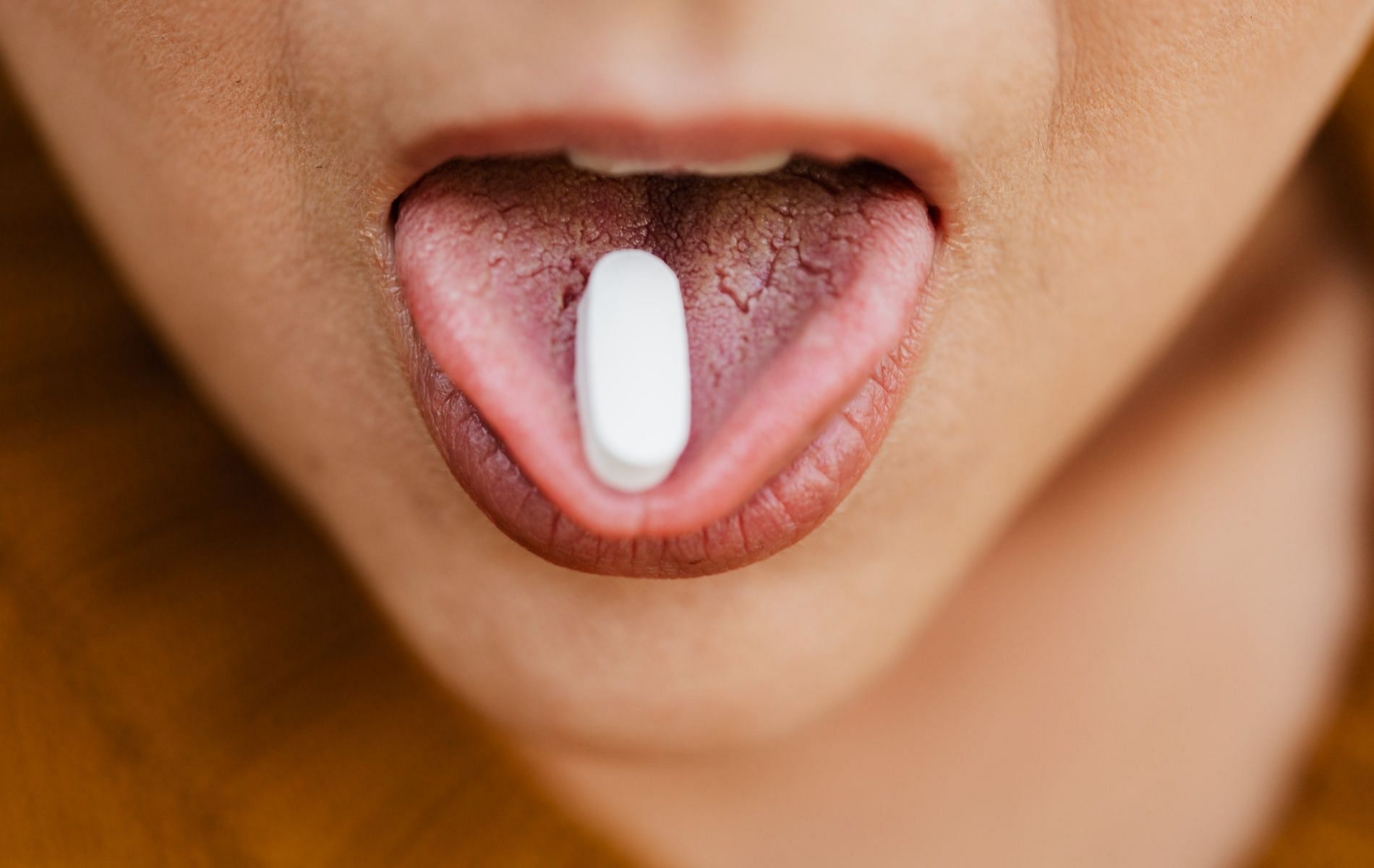 Taking too many antibiotics can develop oral thrush which can cause mucosal damage (Image by Karolina Grabowska via Pexels)