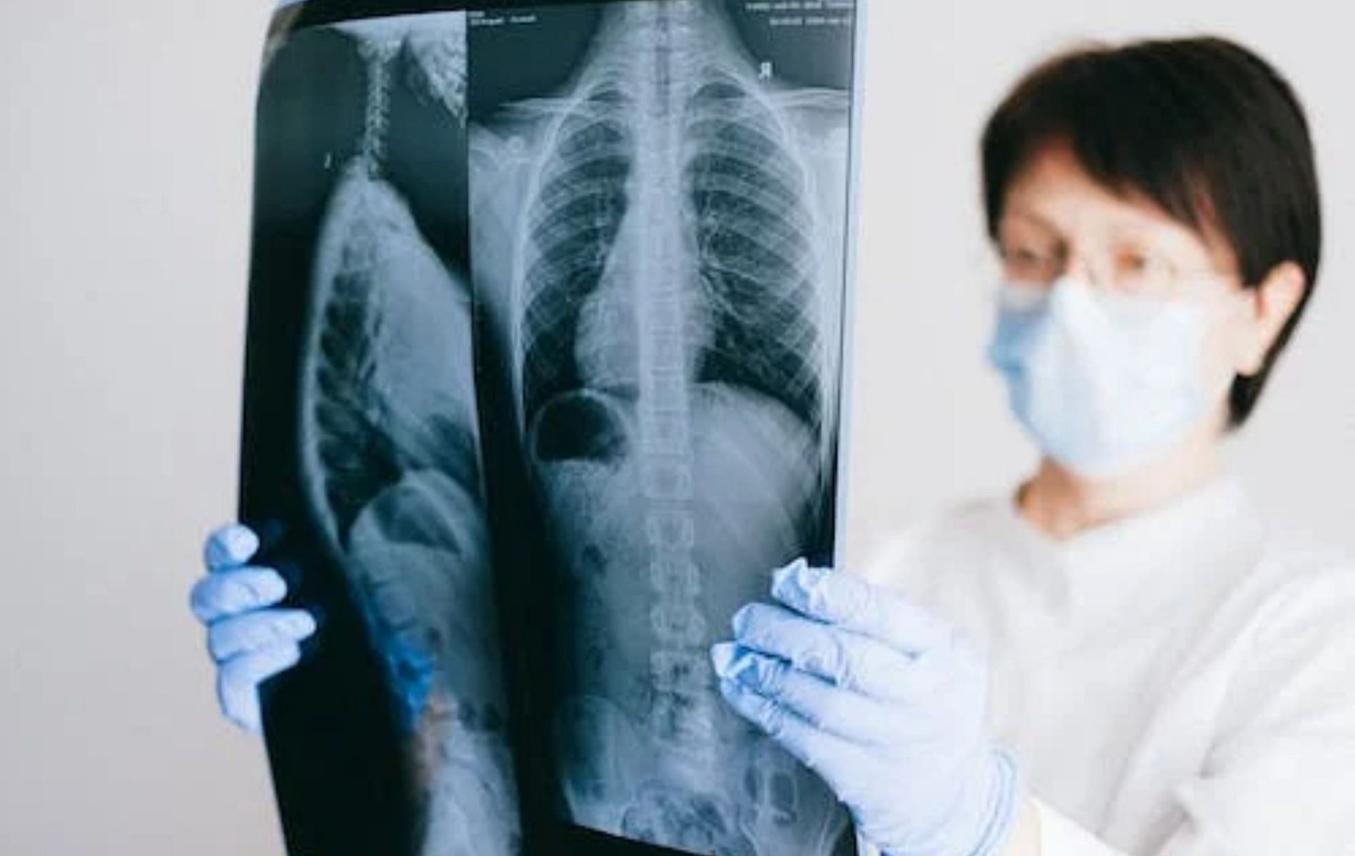 An emergency tracheotomy was performed on Paul Alexander to remove the lung congestion (Image via Pexels)