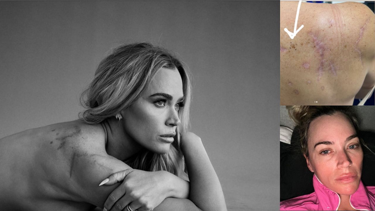  RHOBH alum Teddi Mellencamp reveals another melanoma (image via @teddimellencamp/Instagram)