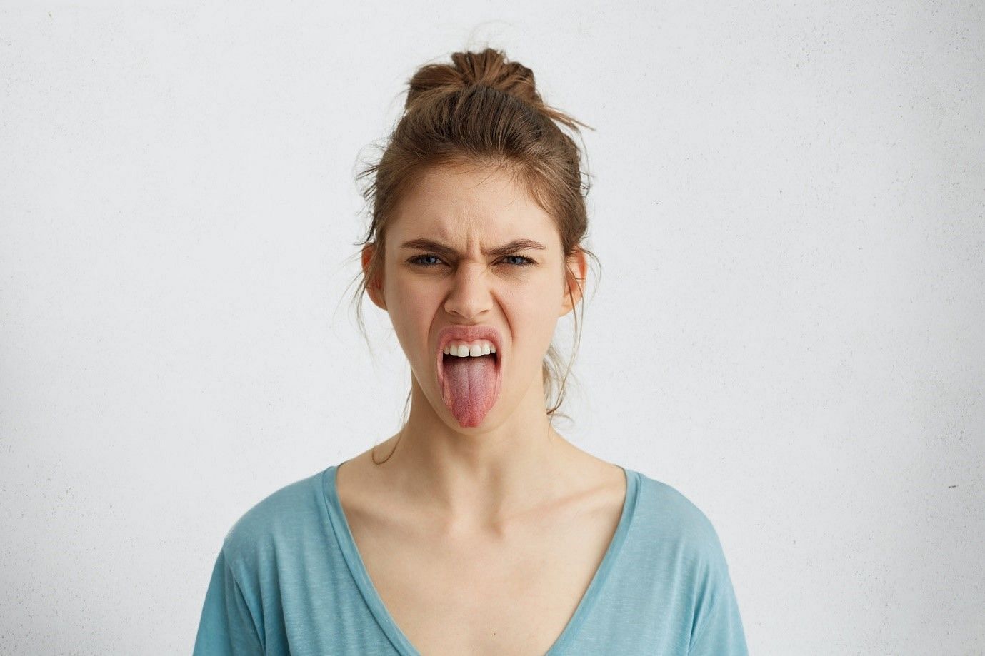 Pimples on tongue are also commonly known by the name of Mouth Ulcers (Image by Wayhomestudio on Freepik)