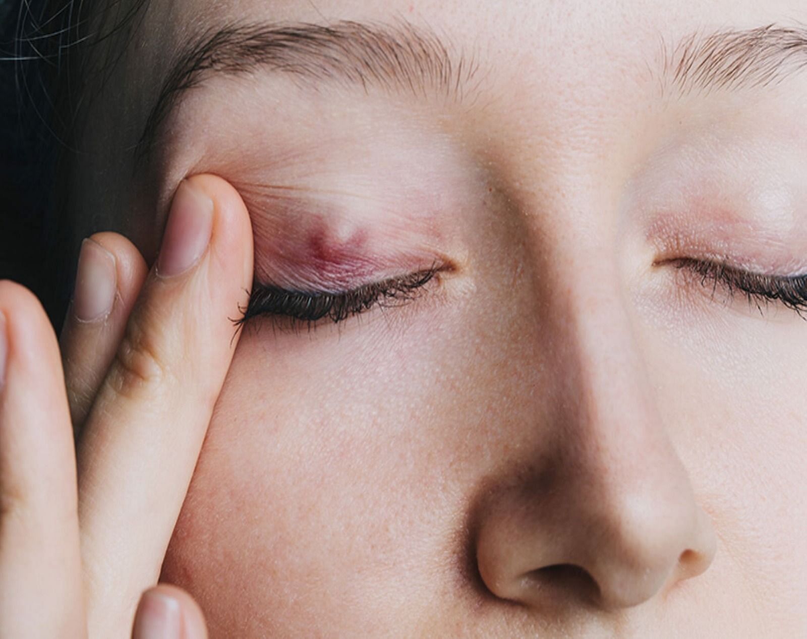 Eye bump (Image via Getty Images)