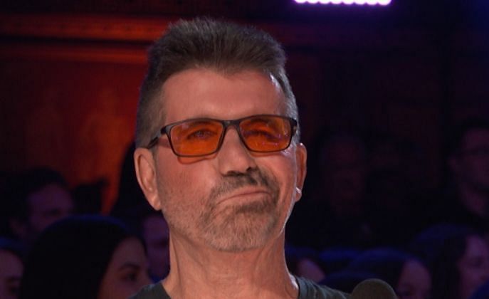 Did Simon Cowell have plastic surgery?